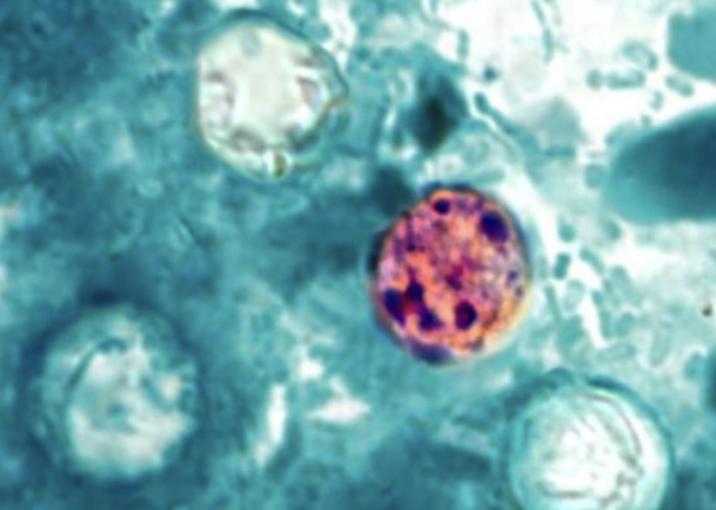 Cause of cyclospora cases eludes CDC as officials urge food safety practices