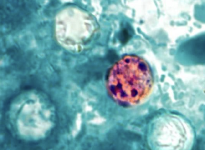 Cause of cyclospora cases eludes CDC as officials urge food safety practices