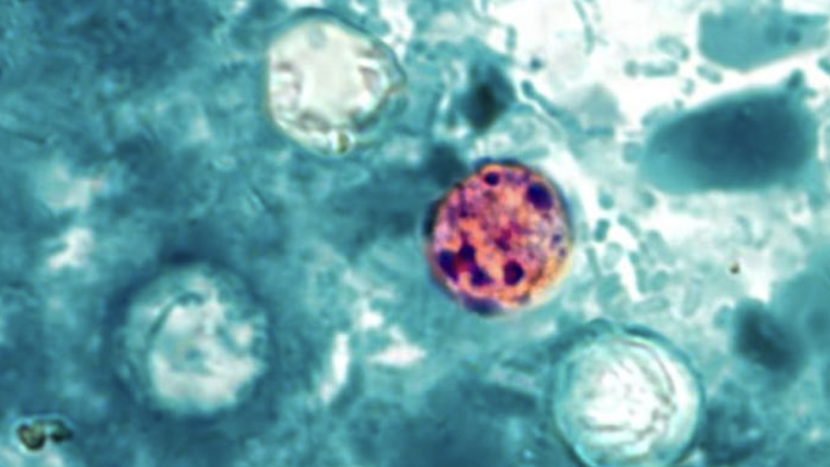 Cause of cyclospora cases eludes CDC as officials urge food safety practices