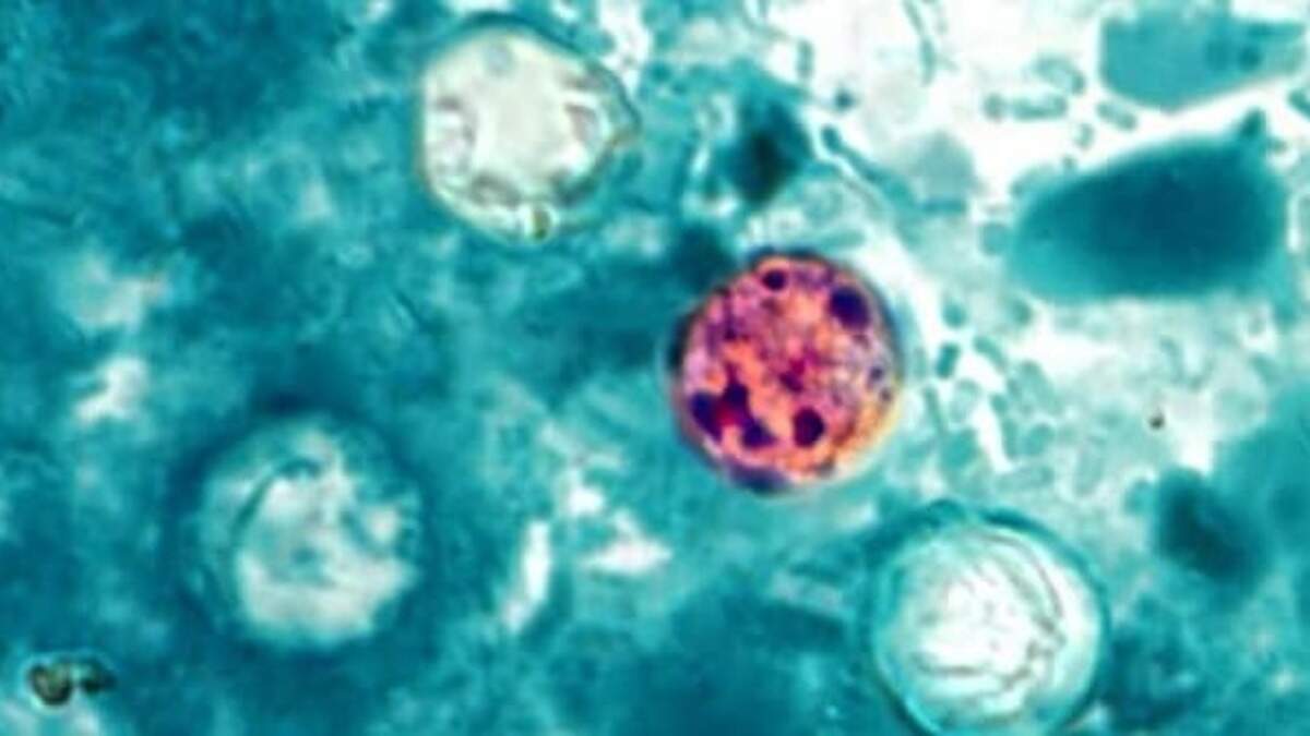 Cases of cyclosporiasis, ‘explosive’ illness from parasite, are rising in NC