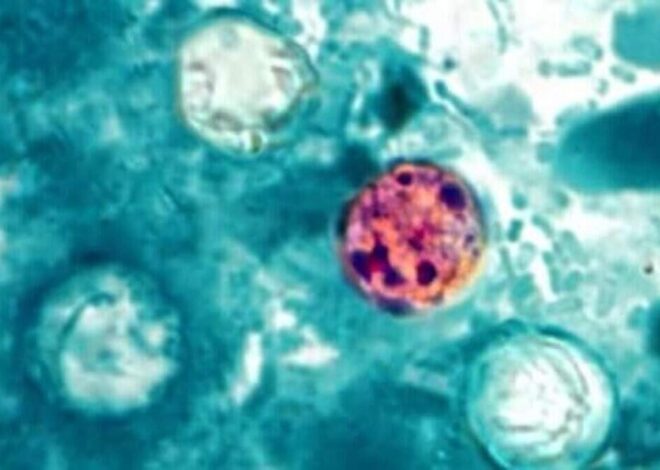 NC cyclosporiasis cases do not appear to be linked to Taco Bell, says DHHS