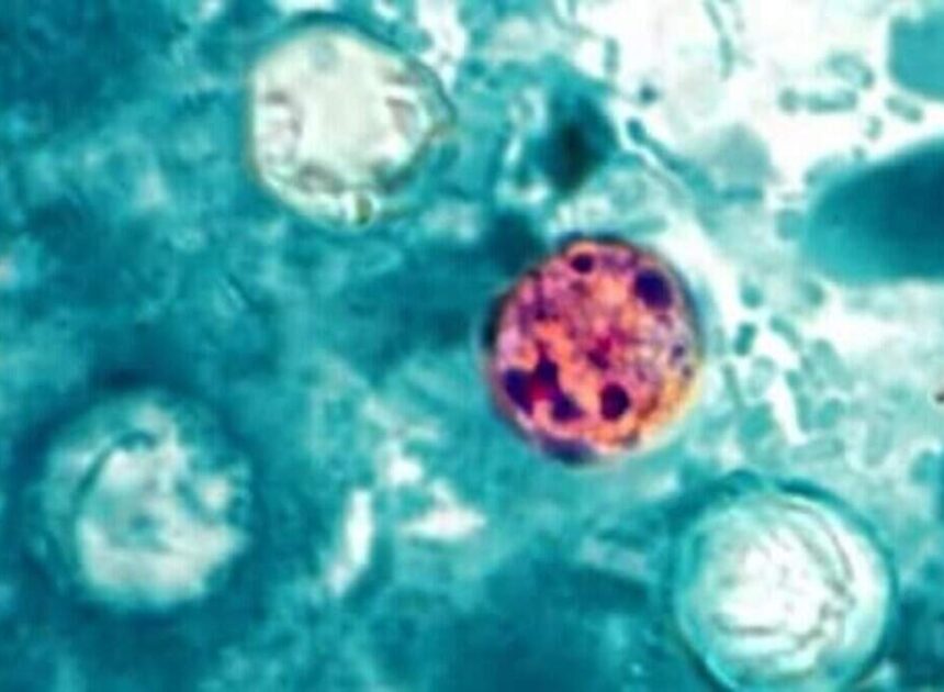 NC cyclosporiasis cases do not appear to be linked to Taco Bell, says DHHS
