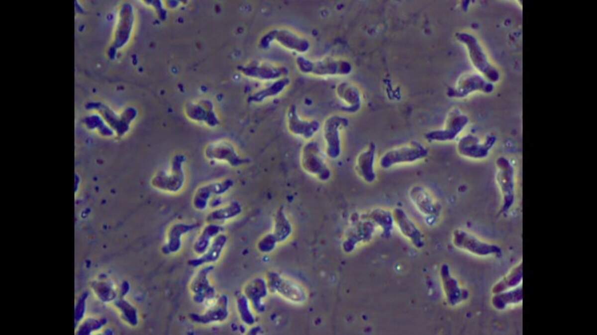 A brain-eating amoeba has resurfaced in NC. Here’s what to know