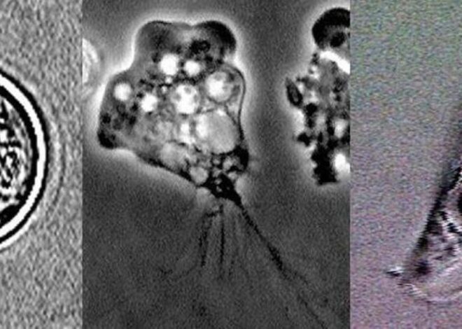 NC teenager infected with brain-eating amoeba has died. What we know