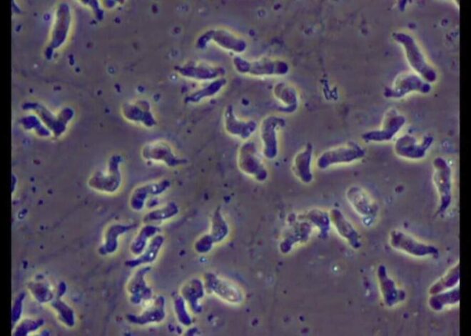 NCDHHS investigating brain-eating amoeba infection source that killed NC teen