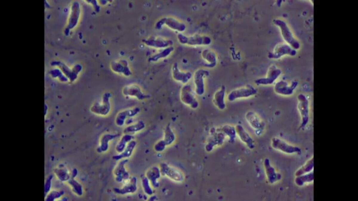 NCDHHS investigating brain-eating amoeba infection source that killed NC teen