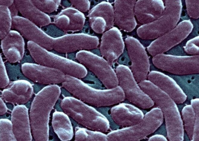 A flesh-eating bacteria has been deadly in NC. Here’s the latest this year
